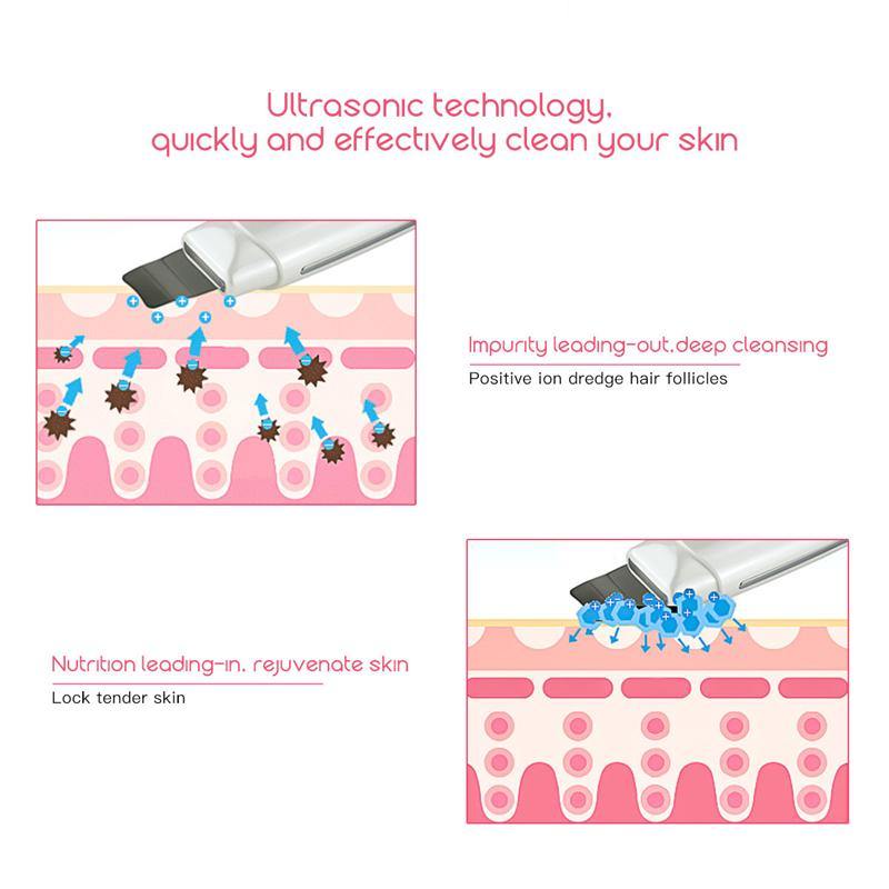 Ultrasonic Deep Face Cleaning Skin Scrubber - CoolCatGadget